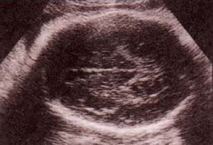 Anomalías en la forma del cráneo