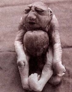 Pentalogia de Cantrell