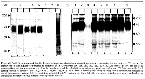 Perfil de inmunoprecipitación