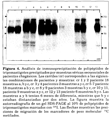 Análisis inmunoprecipitación