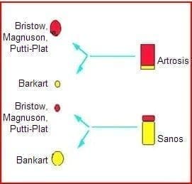 Ejemplo de definición de "caso y control" como enfermo o sano Ejemplo de definición de "caso y control" como enfermo o sano