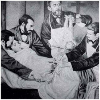 PRIMERA OPERACIÓN CESAREA PRACTICADA EN COLOMBIA