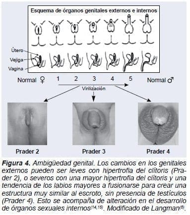 Ambiguedad Genital