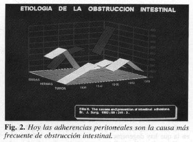 Adherencias peritoneales la causa más frecuente de obstrucción intestinal Adherencias peritoneales la causa más frecuente de obstrucción intestinal