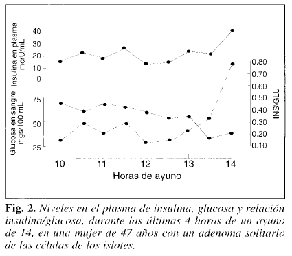 Niveles en el plasma de insulina Niveles en el plasma de insulina