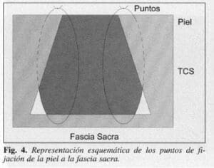 Puntos de fijación de la piel a la fascia sacra Puntos de fijación de la piel a la fascia sacra