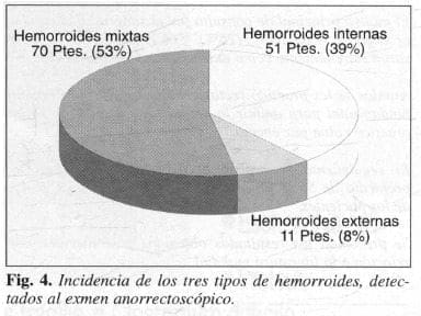 Tipos de hemorroides Tipos de hemorroides