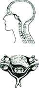 Hernia discal cervical Hernia discal cervical