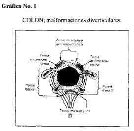 Colon malformaciones