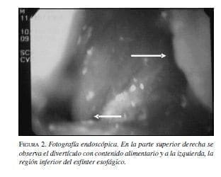 Fotografía endoscópica