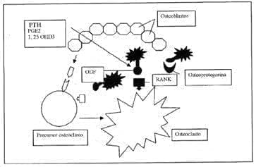 Osteoclastos