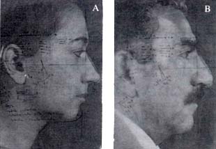 Estudio estético prequirúrgico