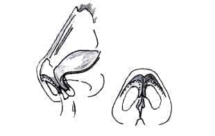 Vía Externa Vía Externa