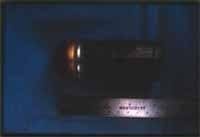 Traqueostomia bajo anestesia local Traqueostomia bajo anestesia local