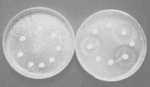 Protocolo de Antibiogramas en orina