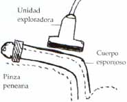 Ultrasonografia de la uretra Ultrasonografia de la uretra