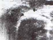 vu-113- Figura 6b Cistouretografia miccional de la uretra