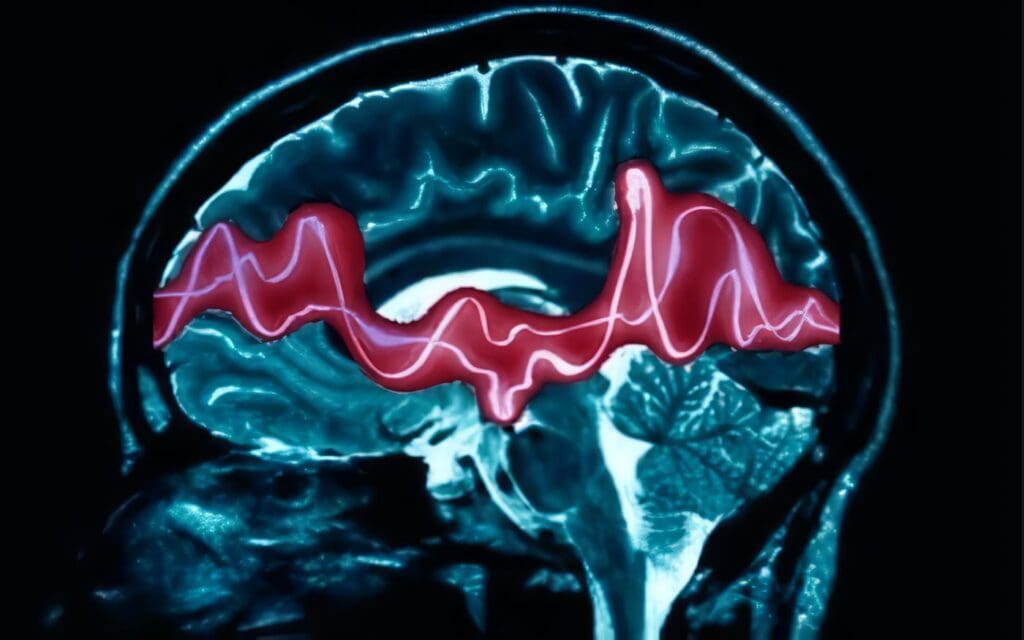 El TDAH retrasa el desarrollo de ciertas áreas del cerebro