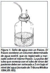Sello de agua con un frasco, sin succión Sello de agua con un frasco, sin succión