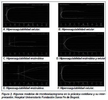 Algunos modelos de tromboelasograma