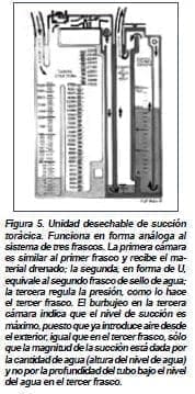 Esternotomía, Unidad desechable de succión Esternotomía, Unidad desechable de succión