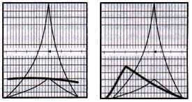 Alteraciones de pruebas audiológicas Alteraciones de pruebas audiológicas