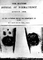 Colcott-Fox T analiza históricamente la descripción de Bazin del eritema indurado que lleva su nombre.