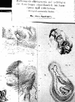 Dibujo del Dr Hans Eppinger en 1887 Dibujo del Dr Hans Eppinger en 1887