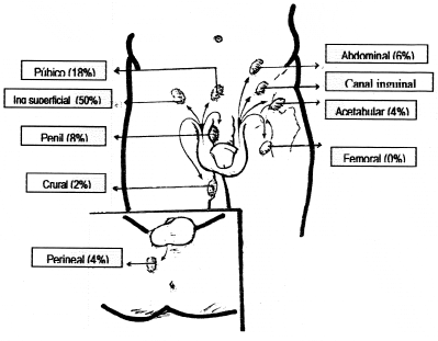 Sitios de dislocación traumática del testículo