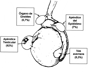 Apéndices intraescrotales y porcentajes de torsion