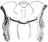 Correcion de las patologías coexistentes