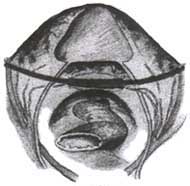 Fijacion de la cúpula vaginal con una cinta