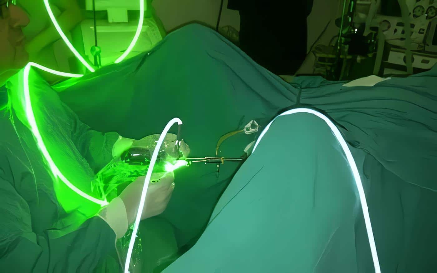 vu101- Prostatectomia Transuretral por Láser