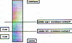 Cálculo del rango apropiado para la localización del tubo Cálculo del rango apropiado para la localización del tubo