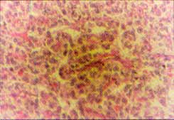 Pieza microscopica estroma fibrovascula Pieza microscopica estroma fibrovascula