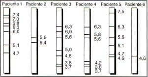 Patrón de bandas de proteínas de extrato de F Patrón de bandas de proteínas de extrato de F