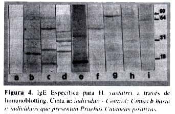 Pruebas Cutáneas negativas no evidenciaron IgE Reactivas Pruebas Cutáneas negativas no evidenciaron IgE Reactivas