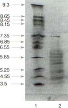 Distribución de las proteínas del extracto de F Distribución de las proteínas del extracto de F