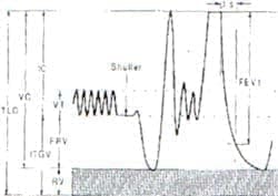 Esquema de la prueba