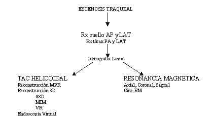Esquema Estenosis Traqueal Esquema Estenosis Traqueal