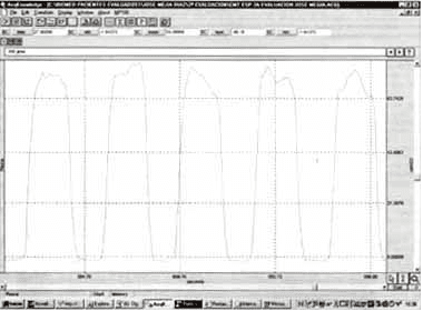Registro típico de la curva de presión en boca (Pboca)