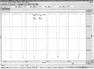 Registro típico de la curva de presión en boca (Pboca)