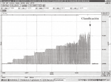 Registro típico de la curva de presión en boca (Pboca )