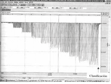 Registro típico de la curva de presión en boca (Pboca )