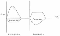 Las curvas de flujo-volumen Las curvas de flujo-volumen