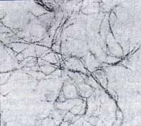 superficie de los medios líquidos