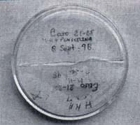 Sensibilidad a la penicilina, Brote de Carbón Bacteriano