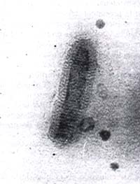 purificación del vev por precipitación con peg y ultracentrifugacion purificación del vev por precipitación con peg y ultracentrifugacion
