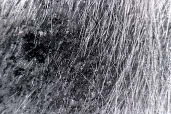 Dermatomicosis Dermatomicosis