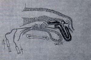 Diagrama de aspiración transvaginal guiada por ultrasonido Diagrama de aspiración transvaginal guiada por ultrasonido